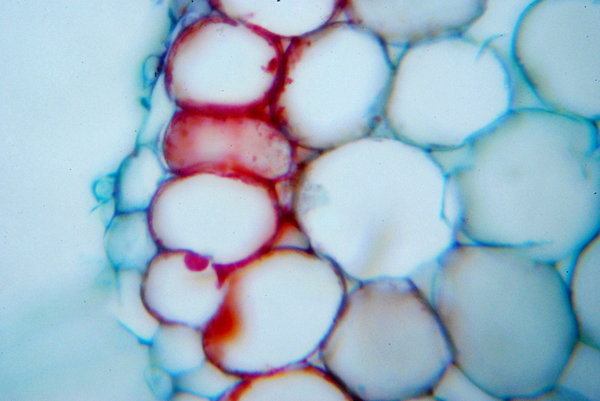 Broad Bean - microscopic view 