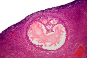 Human's ovarian follicle - mic