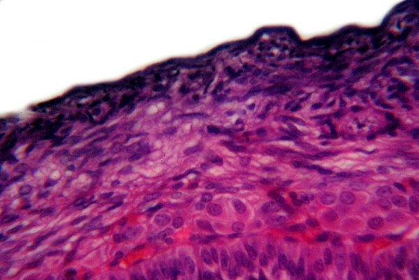 Human's ovarian follicle - mic