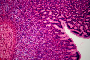 Human's stomach - microscopic : 