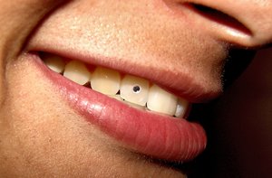 Pierced Smile: She got herself a dental piercing.