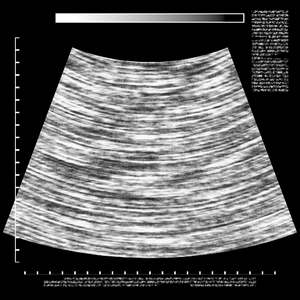 Ultrasound Background