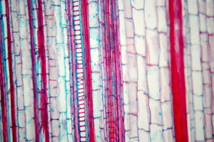 Corn- microscopic view of stal: Maize - view of stalk; magnification 100, 500, 1000 x