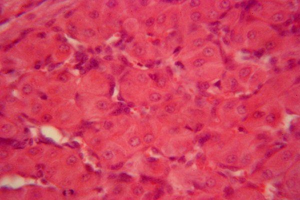 Human's ovarian follicle - mic: Graafian follicle is the basic unit of female reproductive biology and is composed of roughly spherical aggregations of cells found in the ovary. Magnification 100, 500, 1000 x