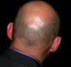 Bald Head: no description