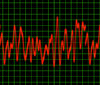 Pulse: Graphic of a heart rate or other rhythm monitor.