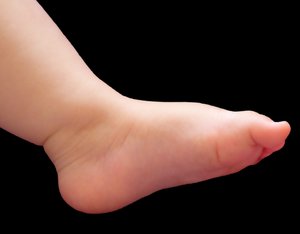 Baby's Foot: A baby's foot against a black background.