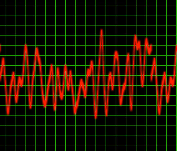 Pulse: Graphic of a heart rate or other rhythm monitor.