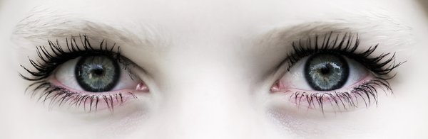 Overdose: Female eyes close-up